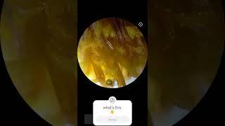#nature  ZOOMX-SCOPE-XO channel subscribe & like & share#biology