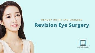 Revision Eye Surgery Clinic Korea/ Eye Surgery before after/ Korea Plastic Surgery