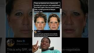 These are identical twins, Brenda (left) smoked, and got more sun, weighed less than Barb (right)