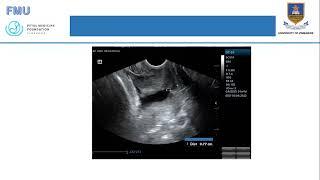 Transvaginal Scan and Pre-term birth Screening - Mr Khumbula