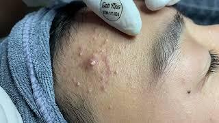 Priority preview content for registered members Spa Linh Mun #99