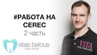 #Стоматолог Стас Белоус делаю #Виниры по цене #мерседес использую #cerec 2 часть