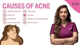 Acne || Hormonal Acne || Causes of Acne || Best Dermatologist In UAE