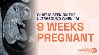 Week 9 of Pregnancy Ultrasound: Brain, Heart & Gender Development