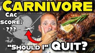 “Carnivore Diet vs Heart Health: My CAC Test Results Are In..”