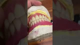 Denture setup #umairtoothfairy #dentist #dentalcrowns #denture #viral #shorts @Umairazeem8553