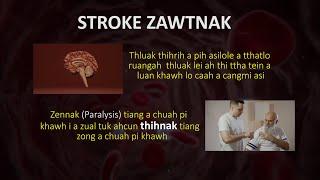 Stroke Zawtnak kong a tawinak in