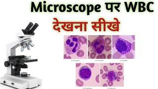 Identify wbc | WBC under microscope |  WBC on slide