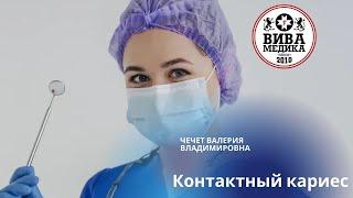 Контактный кариес