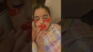 Elif sinem yüzündeki ne #keşfet #elifsinem