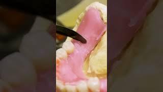How dentures are made. #dentures #teeth #prosthodontist #casting #Insider