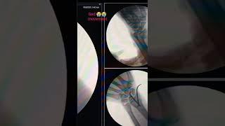 Dr v n singh Bones ke mbbs d ortho successfully completed work #mdadmission #paramedicalcollege