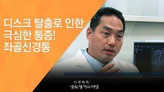 디스크 탈출로 인한 극심한 통증! 좌골신경통 - (2016.2.24_572회 방송)_허리 통증 탈출, C커브를 유지하라