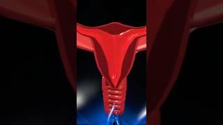 Birth canal #education