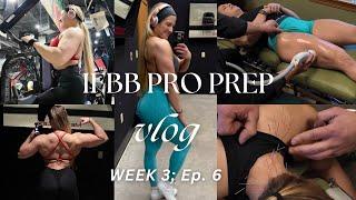 IFBB Prep Week 3: Back/Chest/Leg Workouts, PAINFUL Dry Needling Acupuncture, Physique Update | Ep. 6