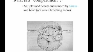 Ortho emergencies PA students 1 - compartment syndrome
