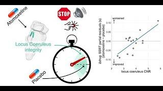 Locus coeruleus integrity and the effect of atomoxetine on response inhibition in PD