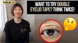 Transform Your Eyes: Double Eyelid Tape vs. Upper Blepharoplasty