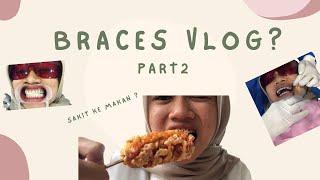 VLOG PART 2 | BRACES JOURNEY , SAKIT KE MAKAN PAKAI BRACES ?