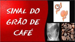 Sinal do grão de café - Volvo de sigmóide