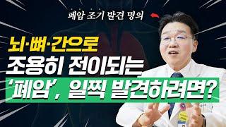 [폐암 조기 발견 명의]비흡연자 폐암 늘어… '이것'으로 조기 발견 가능