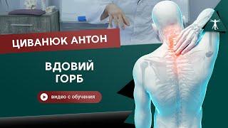 Правда о том, откуда появляется вдовий горб. Циванюк Антон