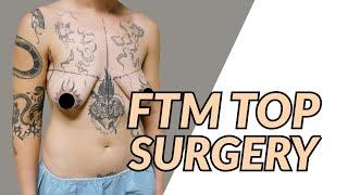 FTM Top Surgery with Dr. Dadvand