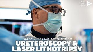 Ureteroscopy and Laser Lithotripsy by Mark D. Tyson II, MD, MPH