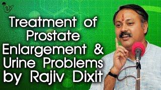 प्रोस्टेट बढ़ने और मूत्र समस्याओं के सरल उपचार | Treatment of Prostate Enlargement & Urine Problems