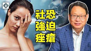 社恐，強迫，痤瘡，禍根在哪里？