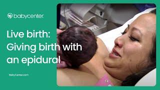 Live birth: Epidural