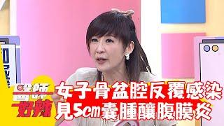 女子骨盆腔反覆感染！檢查驚見5cm囊腫釀腹膜炎！【#醫師好辣】20230827 EP1561 part3