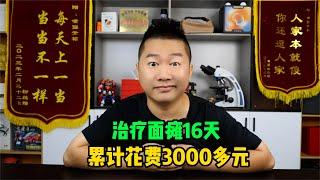 記錄治療面癱的第16天：說話嘴基本上不歪了，累計花費3000多元！