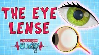 Operation Ouch  - The Eye Lense | Body Facts