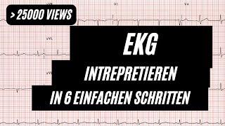 EKG interpretieren in 6 Schritten