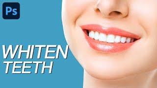 How to Whiten Teeth in Photoshop - 3 Best Methods