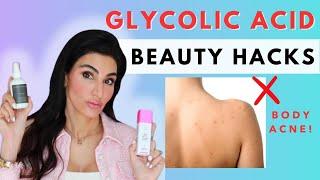 Top 6 GLYCOLIC ACID Beauty Hacks: Target Body Acne, Body Odor, Dandruff & More! | Dr. Azadeh