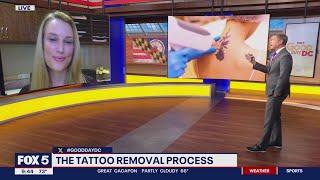 Tattoo regret & removal process