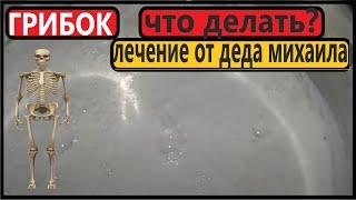 ОТ  ГРИБКА НОГТЕЙ Мощнейший Рецепт Деда Михаила - 200%.