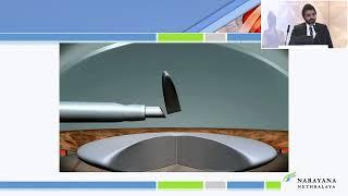 AIOS2025 IC252 T Dr Naren SHETTY Pearls to Get Perfect Chop and Clear Cornea the Next Day
