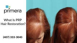 What is PRP Hair Restoration?