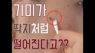 [그녀의 살림창고] 기미가 뚝 떨어지네?? 기미딱지 패치