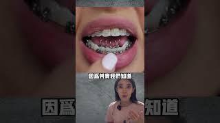 最折磨人的牙套裝置#牙齒矯正#吐舌癖