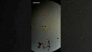 Cell Explodes Under Microscope (Hydrogen Peroxide vs Germs)