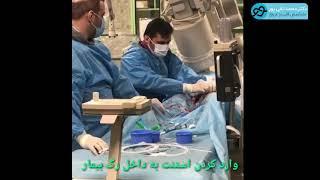 Stenting in the heart (استنت گذاری در قلب)