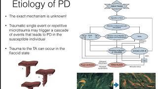 Peyronie's Disease: An Update to Clinical Practice Guidelines