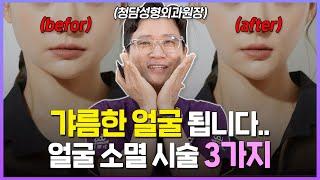 얼굴 작아지는 법(V라인) ※이걸로 종결※ 전문의가 알려주는 확실한 시술 추천 3가지!!