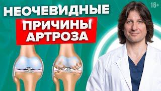 Что нужно знать про артроз, чтобы не упустить время. Что такое артроз и причины артроза.