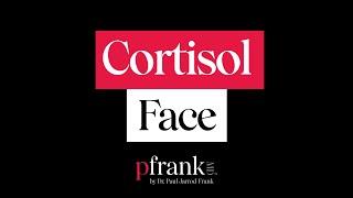 What is “Cortisol Face” or “Moon Face”