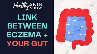 Eczema-Gut CONNECTION | Jennifer Fugo